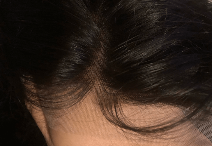 hairline of tinashe hair